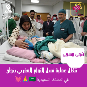 فصل التوأم المغربي ضحى وسجى تتكلل بالنجاح في السعودية