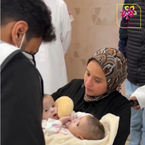 فصل التوأم المغربي ضحى وسجى تتكلل بالنجاح في السعودية